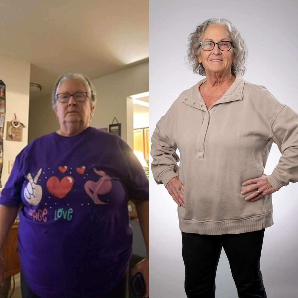 Debbie Jobe before and after weight loss photos.